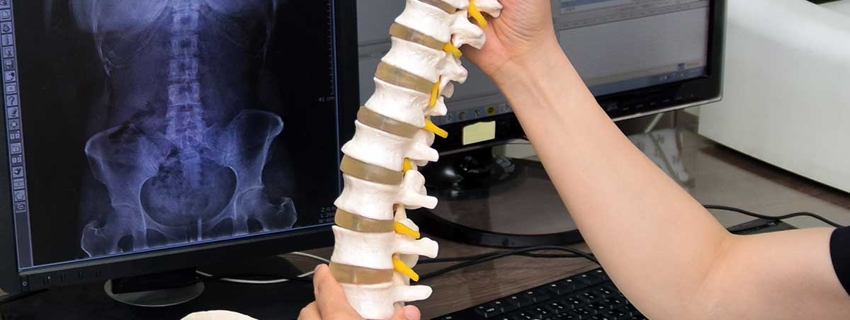 목·허리 통증 상담 및 모형 설명