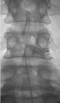 신경성형술 이미지 1